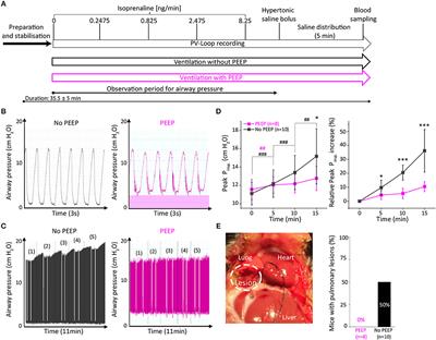 Assessment of PEEP-Ventilation and the Time Point of Parallel-Conductance Determination for Pressure-Volume Analysis Under β-Adrenergic Stimulation in Mice